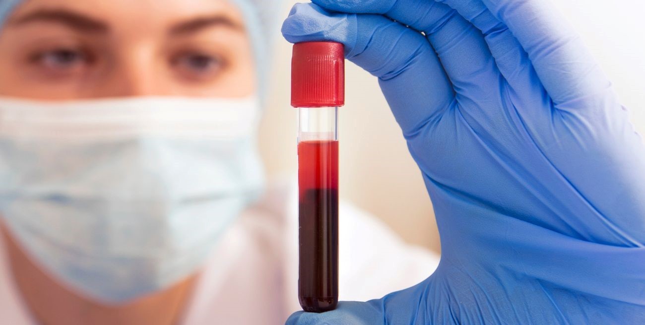 En estudio un test de sangre podría detectar más de 50 tipos de cáncer