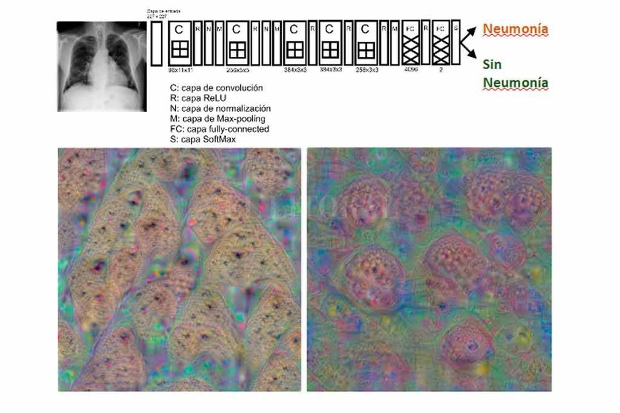 ELLITORAL_239656 |  Gentileza Hugo Paladini Arriba vemos la estructura de la red neuronal entrenada para identificar rx de tórax con neumonía. Abajo vemos que  sueña  la red cuando  piensa  en rx de tórax sin neumonía (abajo a la izquierda) y con neumonía (abajo a la derecha)