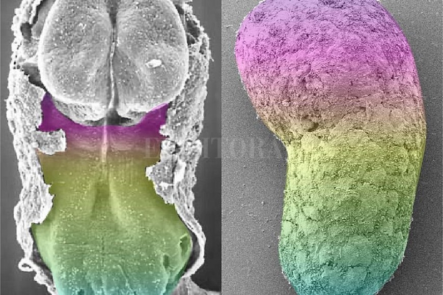 ELLITORAL_307099 |  Naomi Moris Comparación de un embrión humano de 18 a 21 días, a la izquierda, y el modelo de embrión artificial. Los colores indican la expresión de los mismos genes. En el embrión real la parte superior corresponde al cerebro, ausente en el modelo.