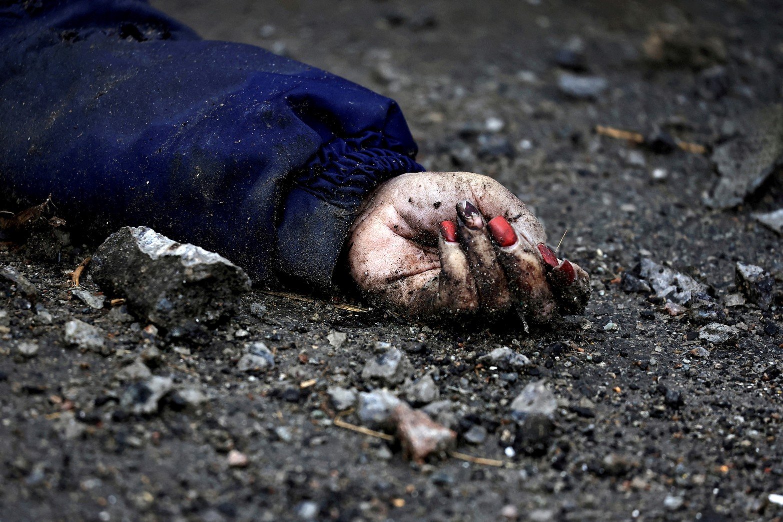 A un año de la invasión de Rusia a Ucrania . La mano de Iryna Filkina, una mujer que, según los residentes, fue asesinada por soldados del ejército ruso, se muestra mientras su cuerpo yace en la calle, en medio de la invasión rusa de Ucrania, en Bucha, región de Kiev, Ucrania el 2 de abril. , 2022