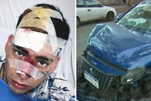 El rostro de Kaleb Di Masi y cómo quedó su automóvil.