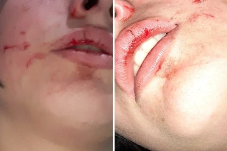 La víctima sufrió lesiones en rostro, cabeza y cuello.