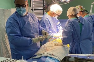 En Quirófano. Tres cirujanos cardiovasculares participaron de la intervención, además del resto del equipo de profesionales de la salud.

Gentileza.