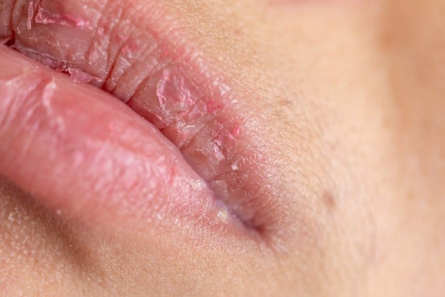 La saliva no solo mantiene la boca húmeda; también limpia los restos de alimentos y los ácidos producidos después de comer.