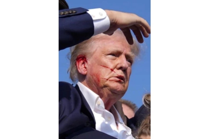 La herida en la oreja de Donald Trump.