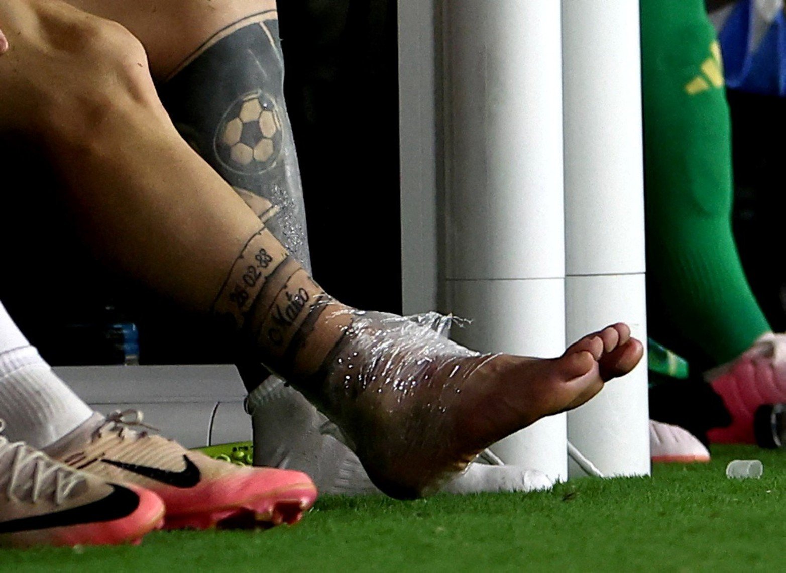 El tobillo de Lionel Messi.
