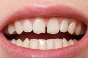 Investigación pionera. Científicos de la Universidad de Kyoto trabajan en el laboratorio para desarrollar el medicamento que podría regenerar dientes perdidos en adultos.