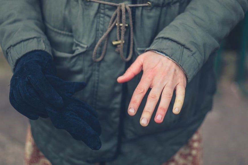 Raynaud es una afección en la que el cuerpo reacciona de forma exagerada a determinadas situaciones.