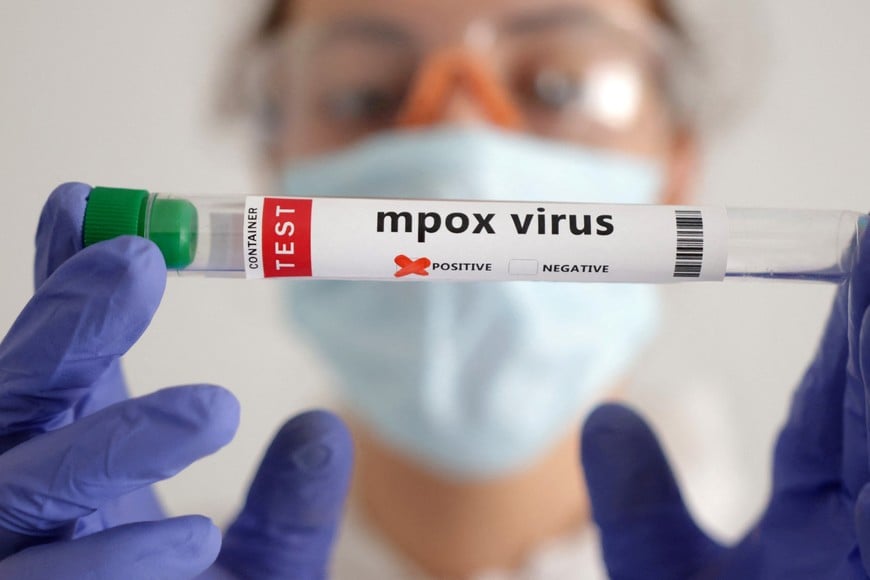 A test tube labelled "Mpox virus positive" is held in this illustration taken August 20, 2024. REUTERS/Dado Ruvic/Illustration