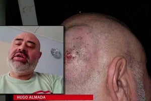 El conductor de la línea 16 compartió la dura experiencia que enfrentó cuando un pasajero lo agredió físicamente.