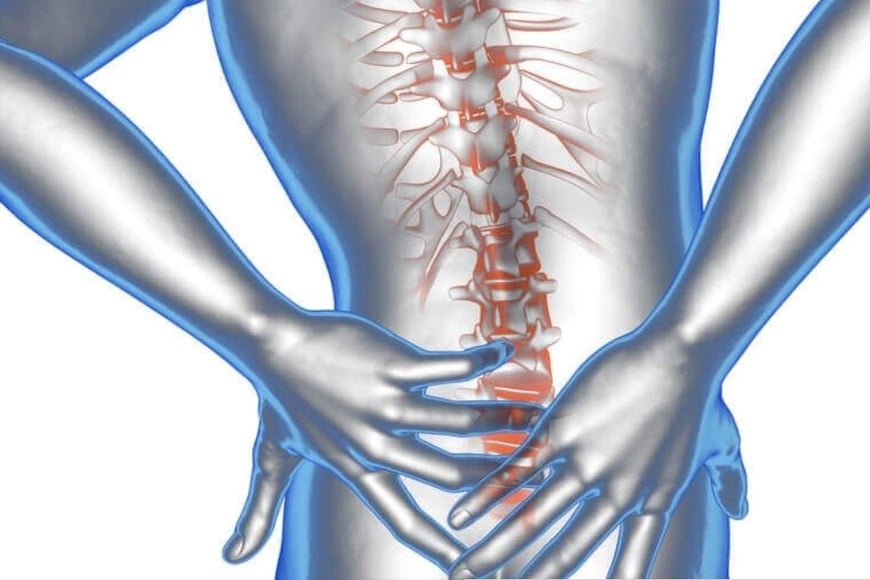 Los primeros síntomas pueden parecerse a los de un dolor lumbar común, lo que podría llevar a ignorarlos o subestimarlos