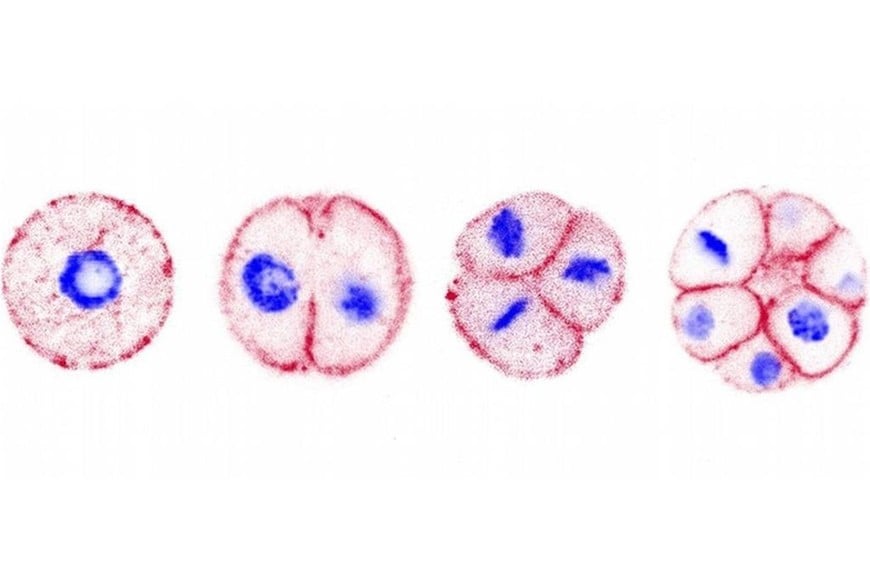 Imágenes del desarrollo multicelular de Chromosphaera perkinsii, primo cercano de los animales.