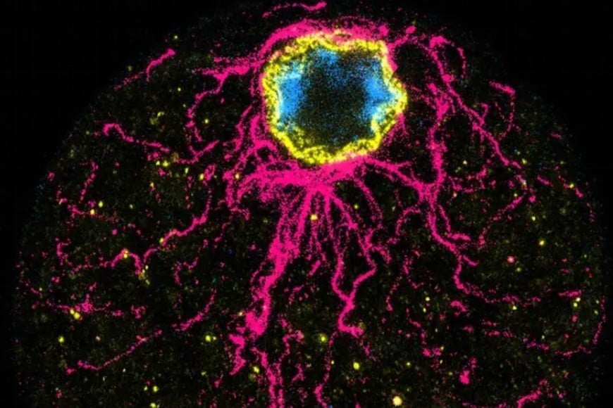 La imagen muestra claros signos de polaridad en Chromosphaera perkinsii.