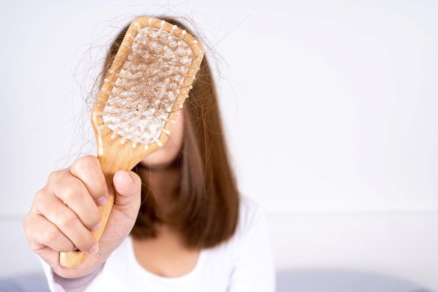 Una dieta desequilibrada puede afectar la salud capilar y acelerar la caída del cabello.