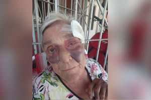 La mujer sufrió golpes en distintas partes del cuerpo.