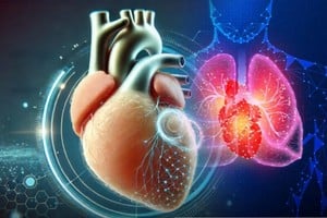 Implante biológico que regenera el tejido del corazón