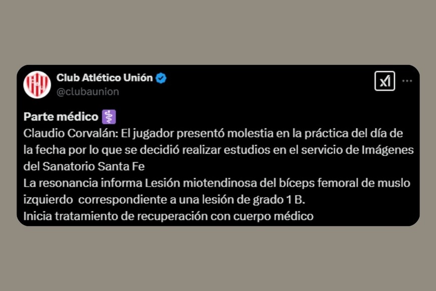 La publicación de Unión sobre Corvalán en X.