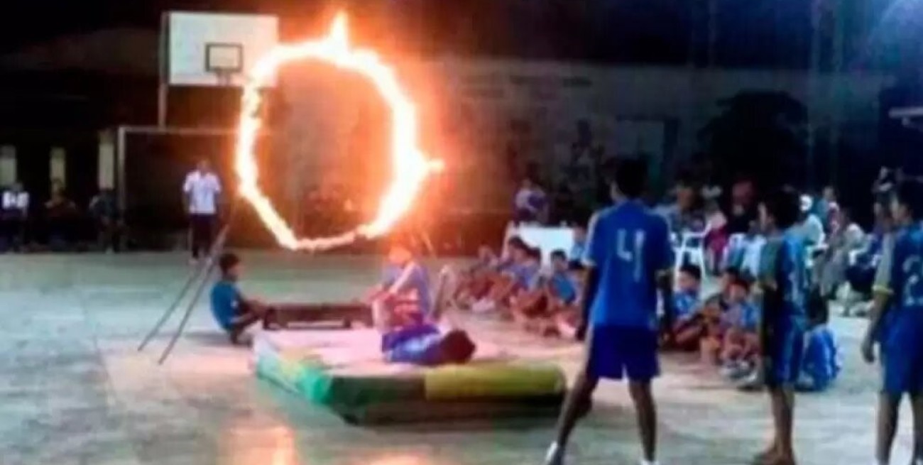 Impactante accidente: un niño de 9 años gravemente herido tras prenderse fuego en un acto escolar