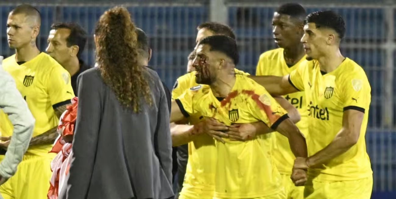 Un jugador de Peñarol recibió un piedrazo, se desmayó en el vestuario y fue internado
